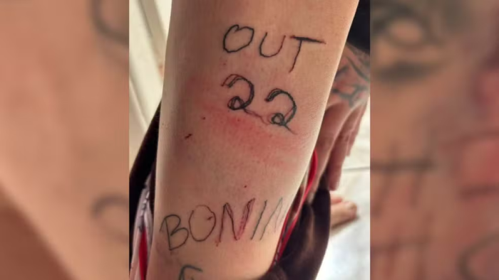 Vítima foi tatuada à força — Foto: Divulgação/Polícia Civil