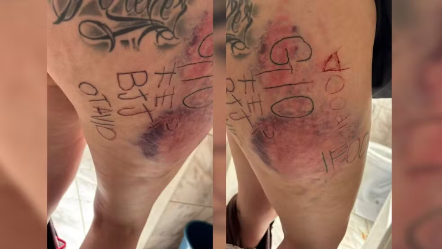 Mulher é torturada, mutilada e marcada com tatuagem à força pelo próprio namorado